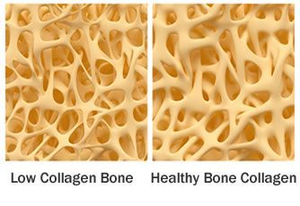 How Much Collagen Should You Take Daily?